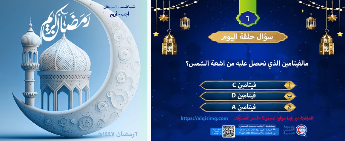 سؤال حلقة اليوم للمسابقة الرمضانية- مخ وأعصاب